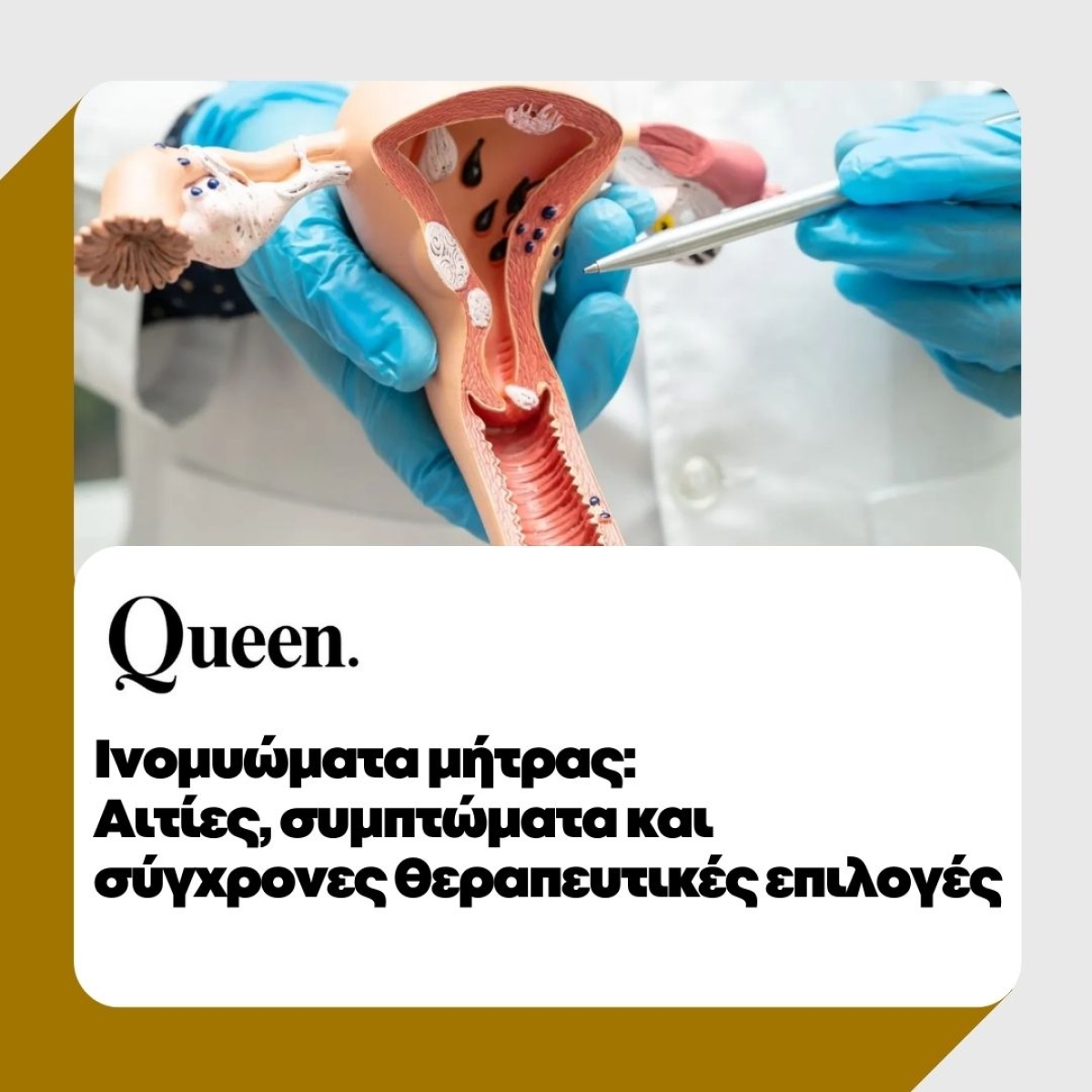 &Iota;&nu;&omicron;&mu;&upsilon;ώ&mu;&alpha;&tau;&alpha; &mu;ή&tau;&rho;&alpha;&sigmaf;: &Alpha;&iota;&tau;ί&epsilon;&sigmaf;, &sigma;&upsilon;&mu;&pi;&tau;ώ&mu;&alpha;&tau;&alpha; &kappa;&alpha;&iota; &sigma;ύ&gamma;&chi;&rho;&omicron;&nu;&epsilon;&sigmaf; &theta;&epsilon;&rho;&alpha;&pi;&epsilon;&upsilon;&tau;&iota;&kappa;έ&sigmaf; &epsilon;&pi;&iota;&lambda;&omicron;&gamma;έ&sigmaf; | queen.gr | 26/02/2025