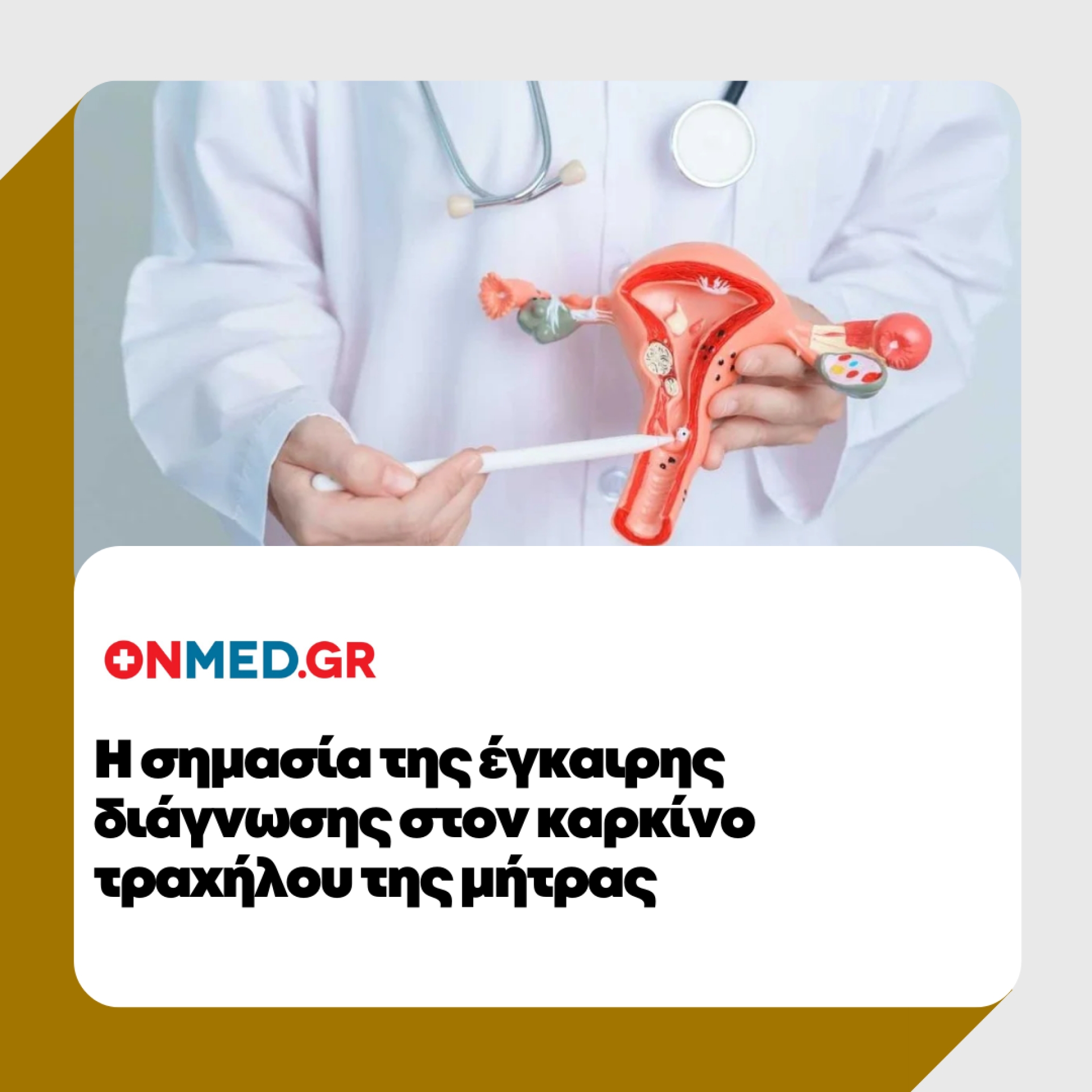 &Eta; &sigma;&eta;&mu;&alpha;&sigma;ί&alpha; &tau;&eta;&sigmaf; έ&gamma;&kappa;&alpha;&iota;&rho;&eta;&sigmaf; &delta;&iota;ά&gamma;&nu;&omega;&sigma;&eta;&sigmaf; &sigma;&tau;&omicron;&nu; &kappa;&alpha;&rho;&kappa;ί&nu;&omicron; &tau;&rho;&alpha;&chi;ή&lambda;&omicron;&upsilon; &tau;&eta;&sigmaf; &mu;ή&tau;&rho;&alpha;&sigmaf; | onmed.gr | 16/01/2025